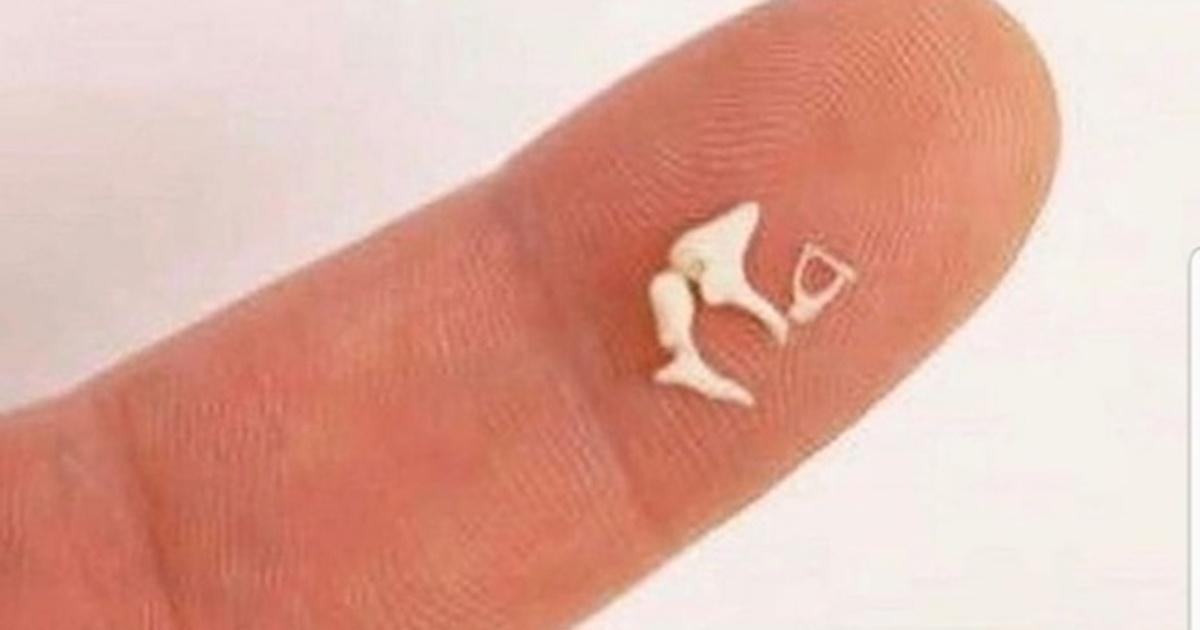 the-smallest-bones-in-our-body-make-a-big-difference-hearing